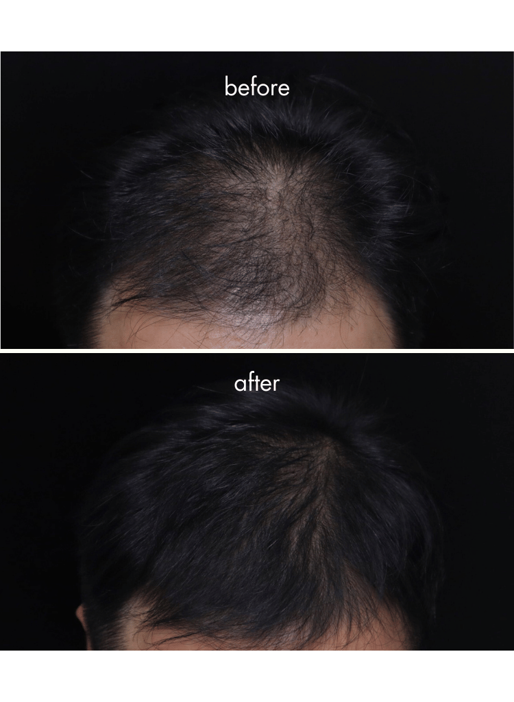 IHAIR Hair Densifying Serum