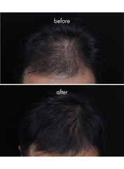 IHAIR Hair Densifying Serum
