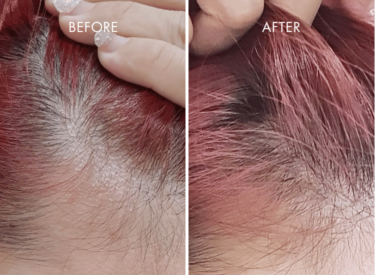 IHAIR-Product_Page_3_727b6cd3-c1a6-4fc8-9fb3-6ec8bd333965.png