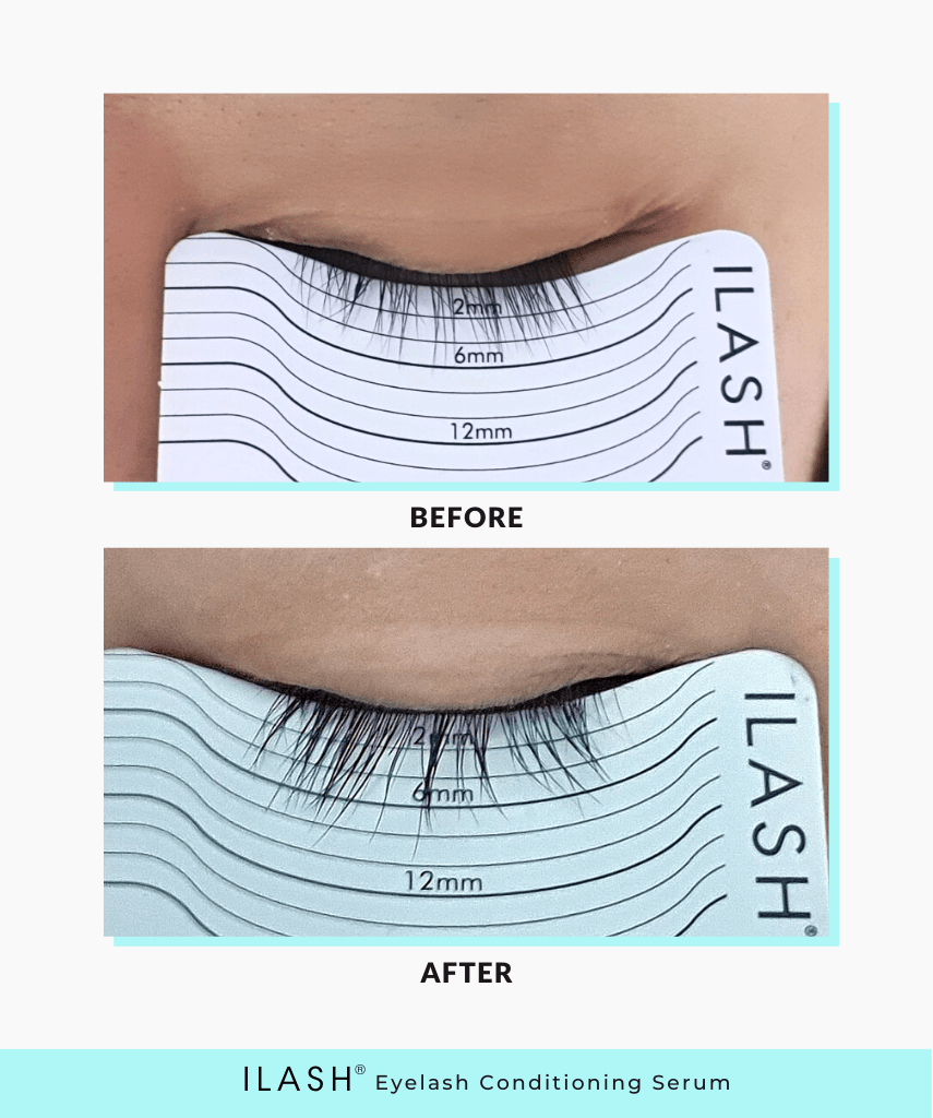 ILASH® Eyelash Conditioning Serum