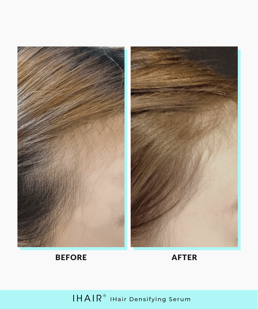 IHAIR® Hair Densifying Serum